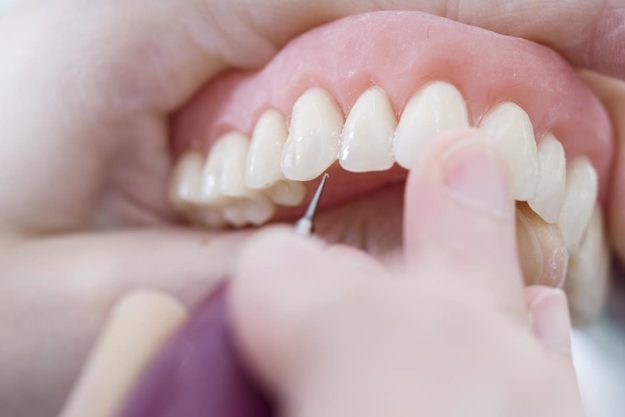 full set of dental implants dentist inspecting same day dental implants