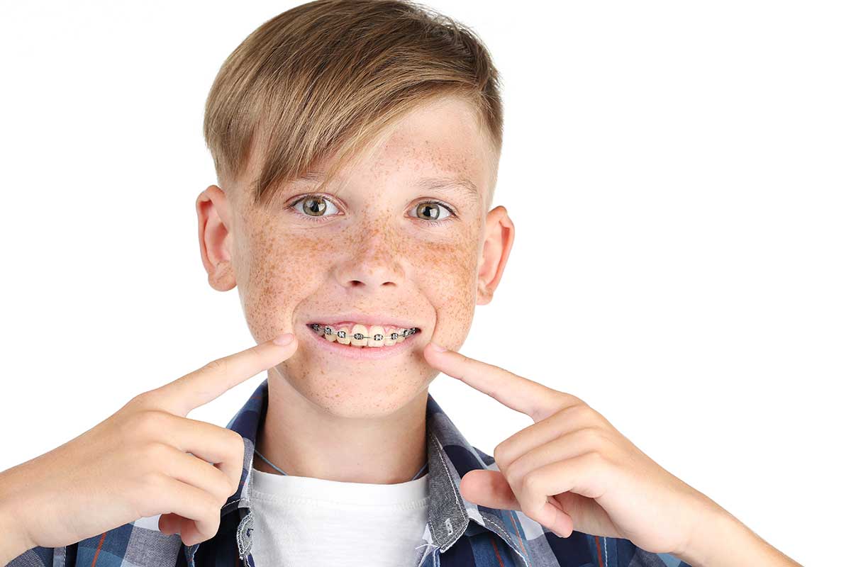 3 Benefits of Braces for Kids (3) young boy getting braces for kids
